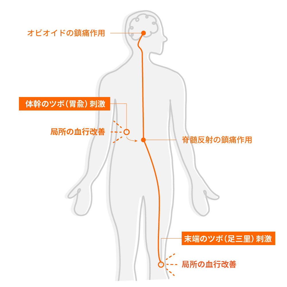 鍼の刺激と体の反応